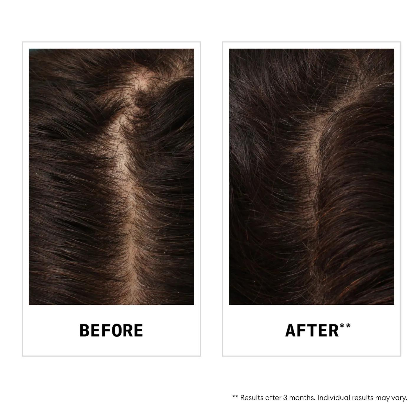 Hair Fall Defense Shampoo 5