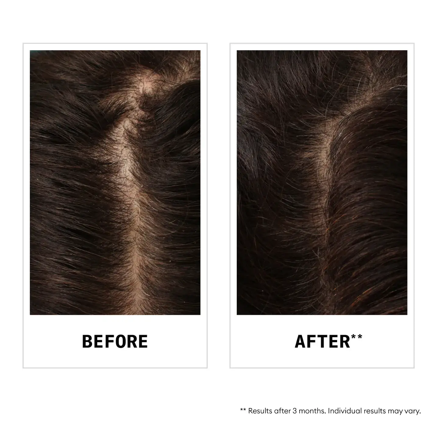 before and after using hair fall defense shampoo