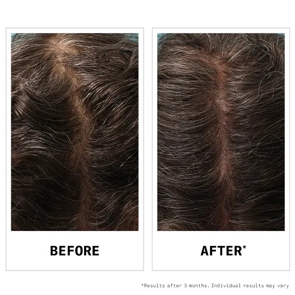 Hair Fall Defense Serum collage background