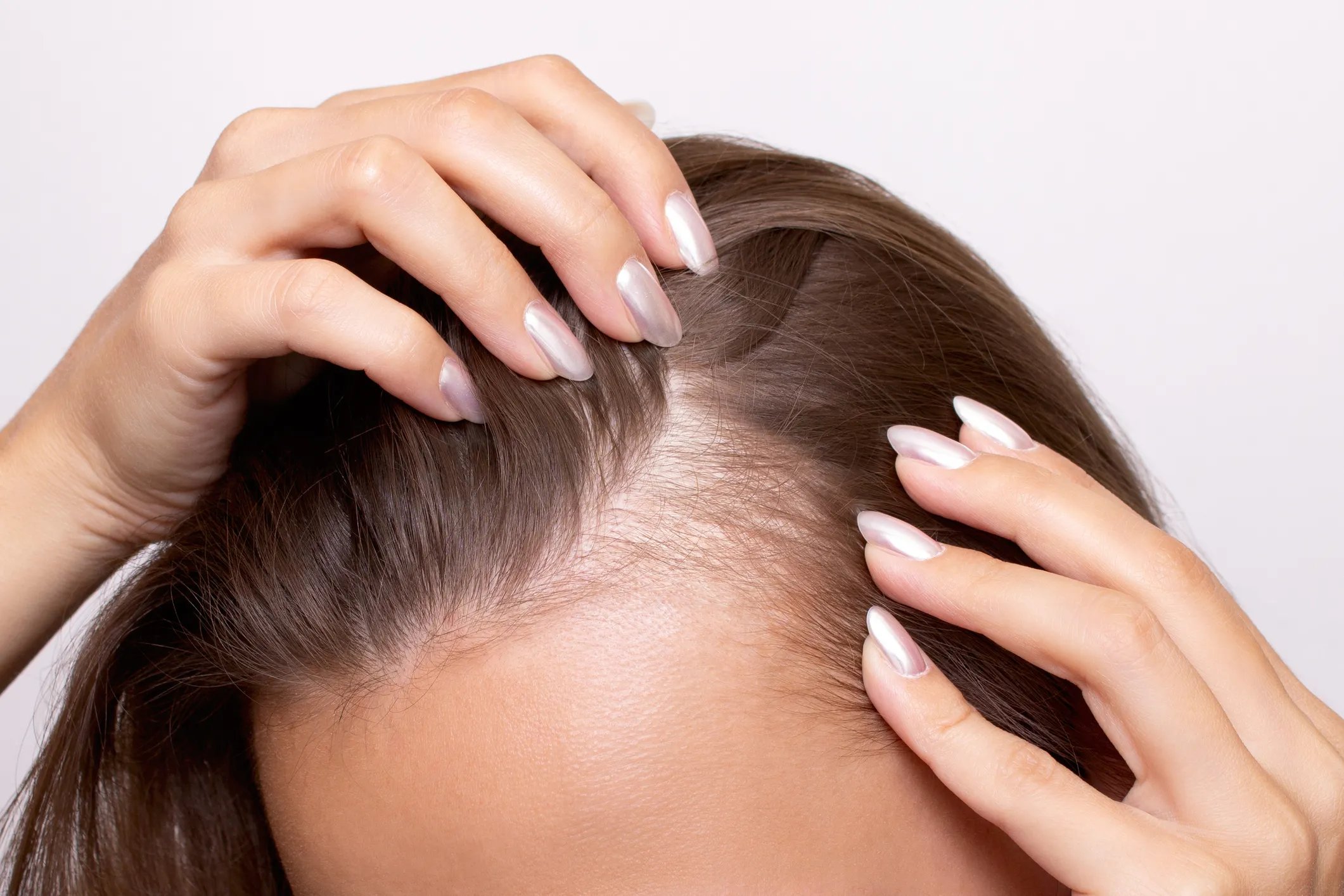 Nioxin_WEBSITE_ONLY_ArticleImage_Dandruff2_2024_JPG