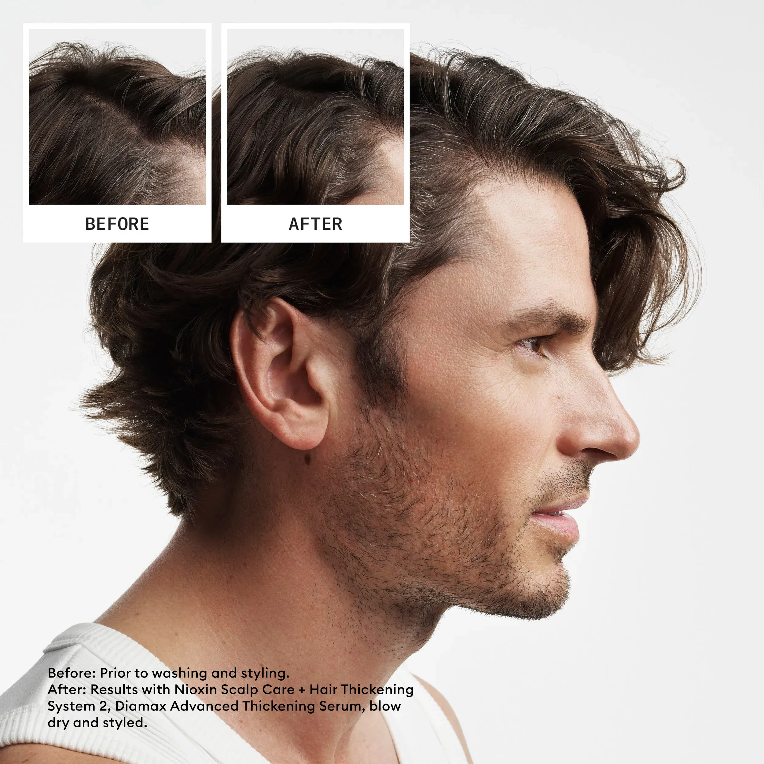 Vorher/Nachher eines Mannes mit braunen, gestylten Haaren nach der Anwendung des Nioxin System Kit 2