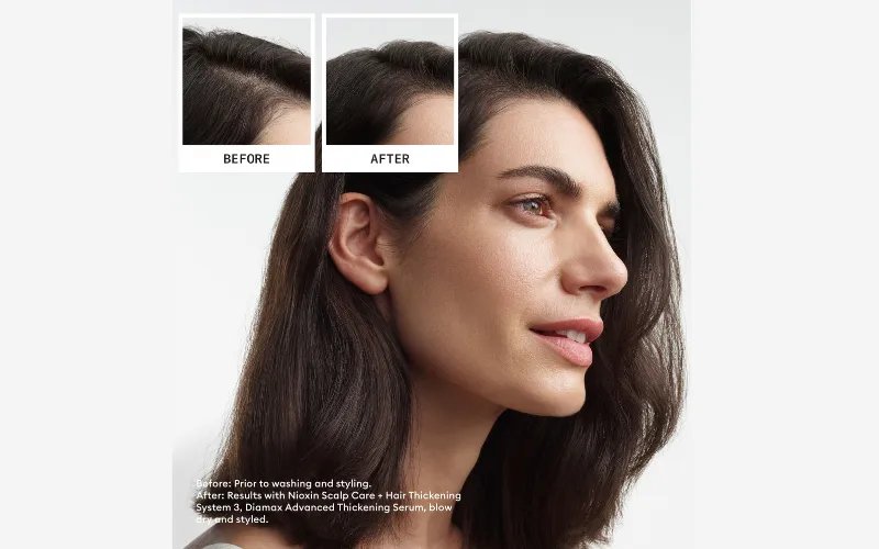 Nioxin_WebsiteBanner_B&A_2024_PNG