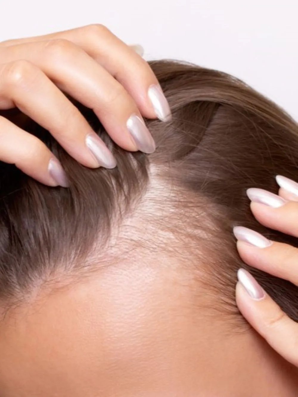 Close-up of hands parting hair to show the scalp and hair roots.