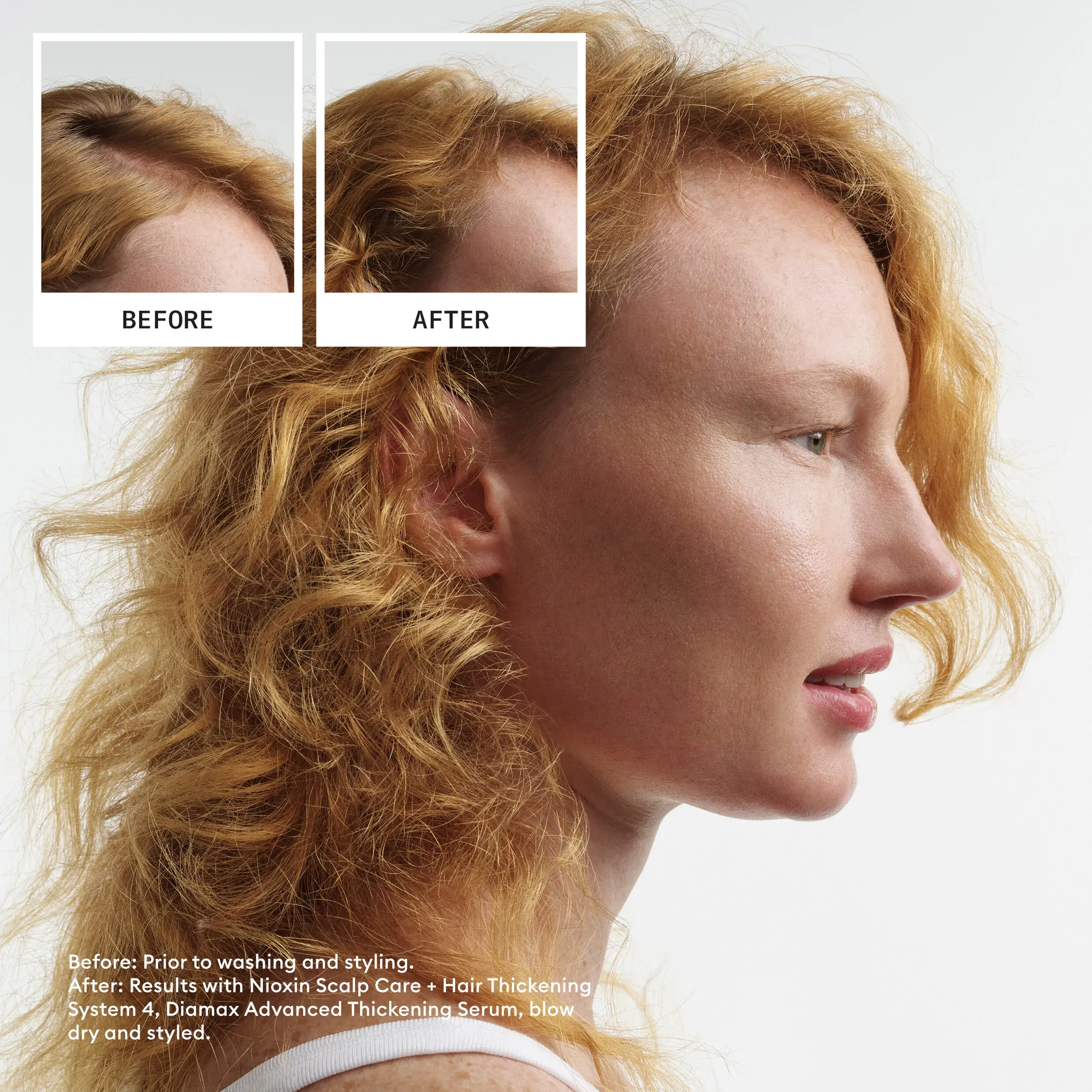 Antes y después de un cabello pelirrojo, tras utilizar el kit de Sistema 4 de Nioxin