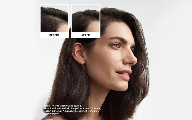 Σύστημα 3 πριν & μετά