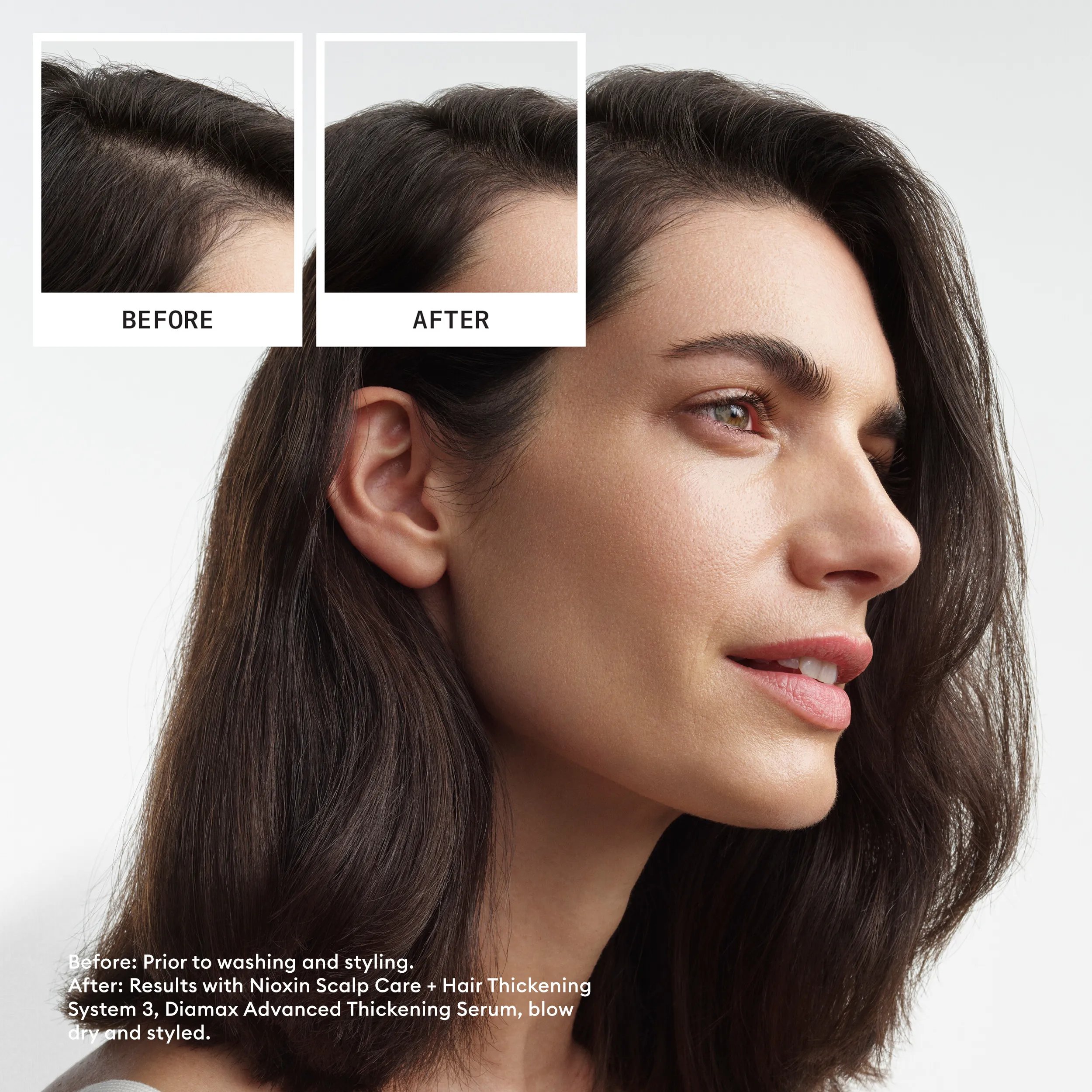 Before and after of scalp on dark hair hair using Nioxin System kit 3  